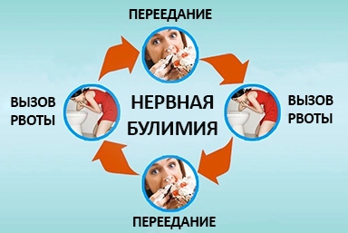 Лечение булимии в Нижневартовске